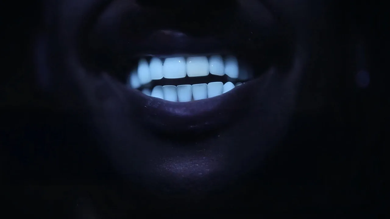 Des dents blanches… au rire jaune !